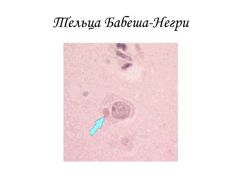 Тельца Бабеша-Негри